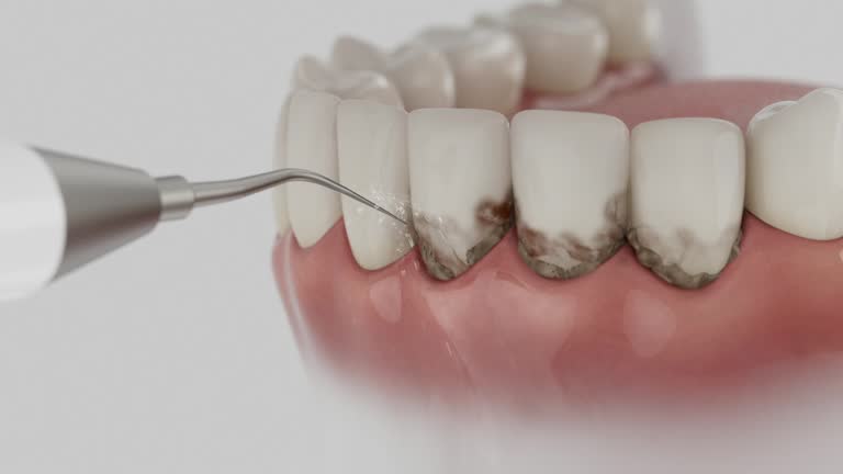 Reliable Dental Implants contractor in Seymour, WI by Smile Center Dentistry